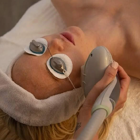 Laser Limelight IPL