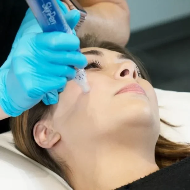 SkinPen Micro Needling