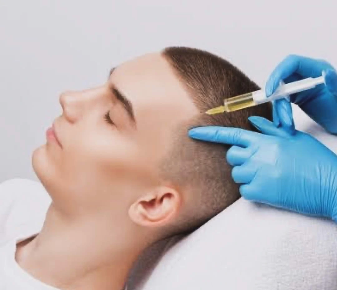 PRP Platelet-Rich Plasma Therapy